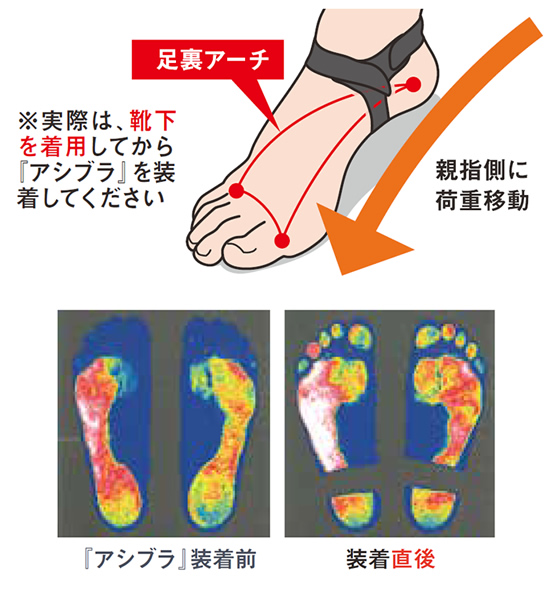 楽天市場】アシブラM01 S-L 男女共用 ashibra : トータルヘルス